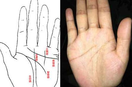 王晨霞 手会说话-掌纹的秘密，王晨霞手诊艺术，掌纹的秘密与健康解读