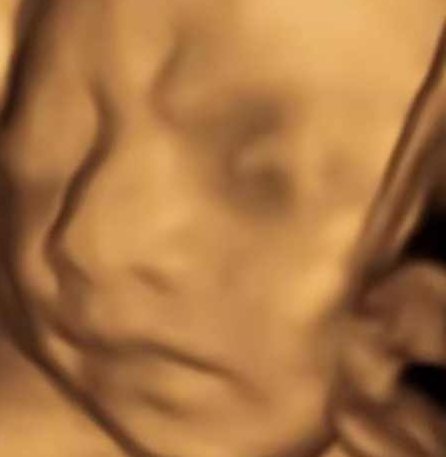 适合0基础小白做的小红书颜值打分小众项目，一条作品收入1000＋【揭秘】揭秘零基础小白也能驾驭的小红书颜值打分项目，轻松一拍，单条作品收益破千的秘诀,课程,教程,基础,第1张