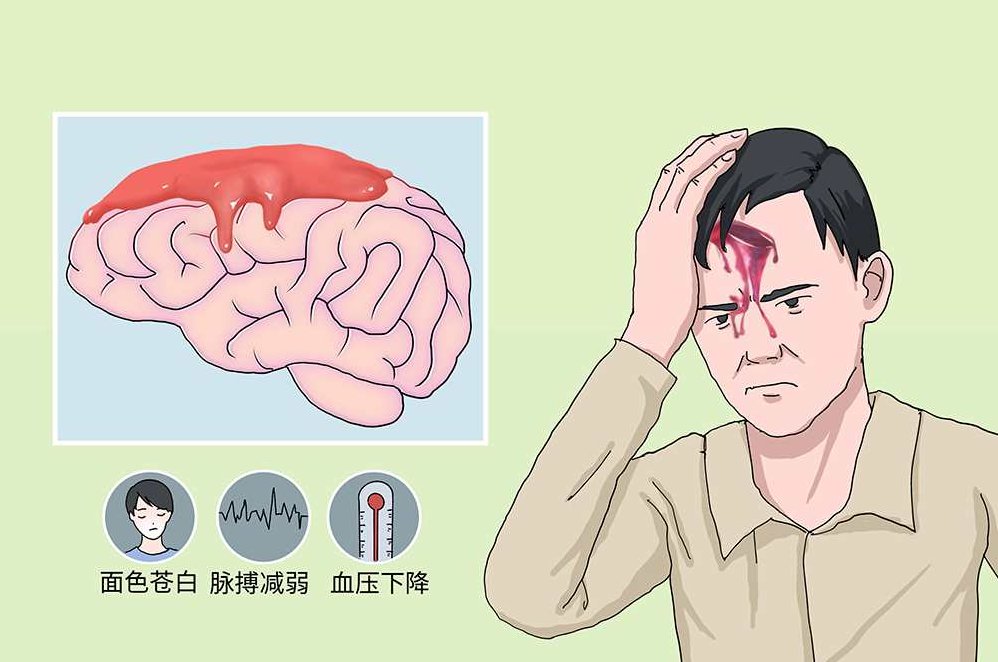 刘彬 颅脑损伤全4集,应用,第1张