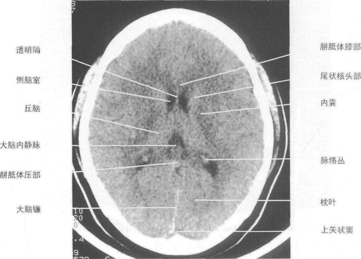 颅脑CT、MR 手把手教你“颅脑影像读片”,课程,基础,掌握,第1张