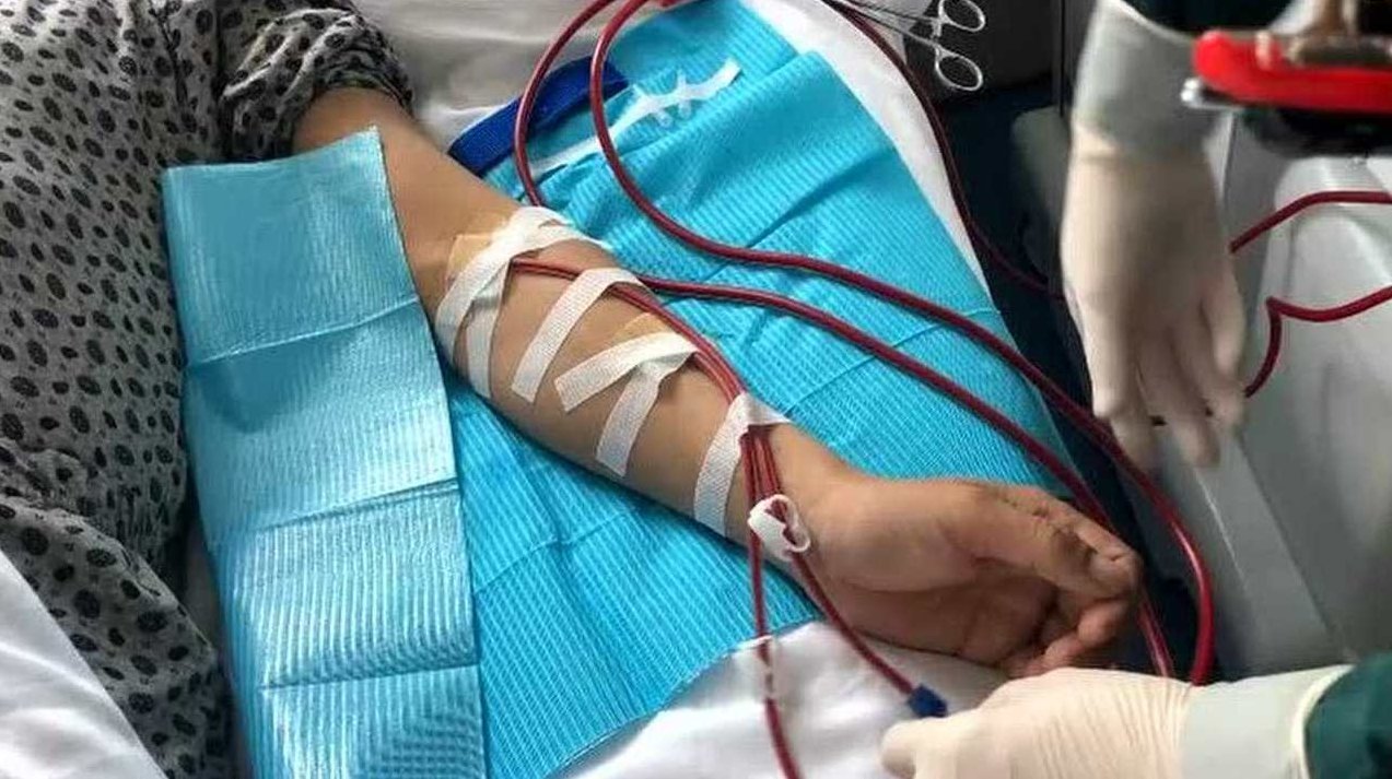 透析知识 血液透析规范化诊疗及护理,培训,掌握,第1张