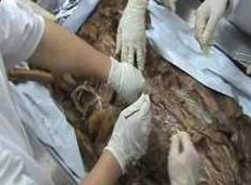 真人解剖医学培训视频教程_解剖教程【实操篇】,视频,教程,视频教程,第1张