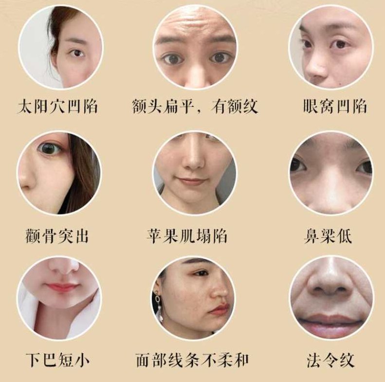 宫廷古方:12节徒手小脸塑颜术,课程,视频,音频课,第2张 宫廷古方:12节徒手小脸塑颜术,课程,视频,音频课,第2张