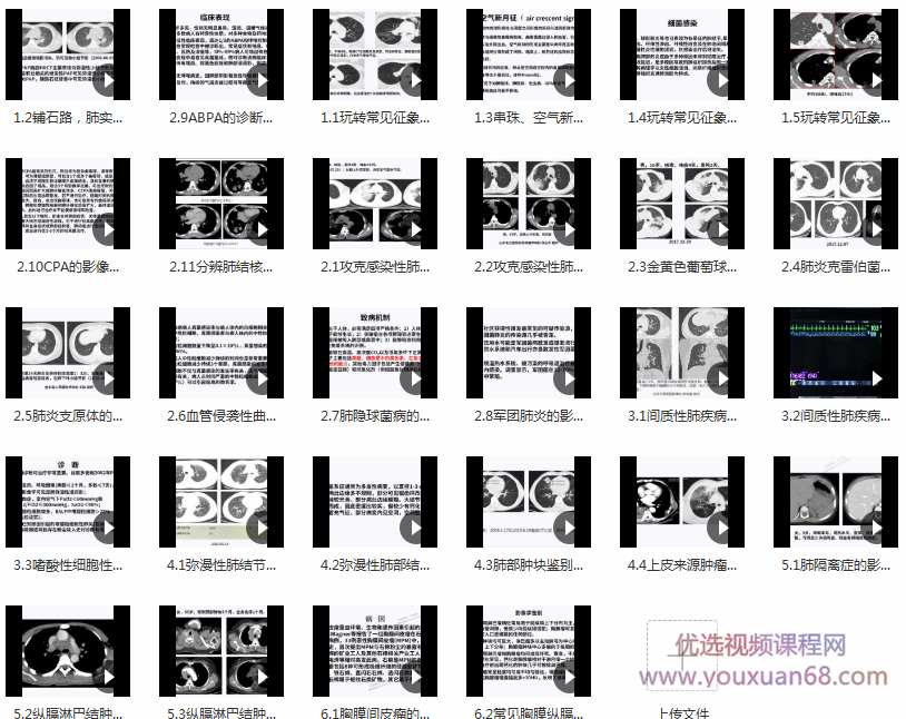 DXY诊断必备-肺部ct的诊断技巧及误区,教你成为肺部CT读片高手,课程,第2张 DXY诊断必备-肺部ct的诊断技巧及误区,教你成为肺部CT读片高手,课程,第2张
