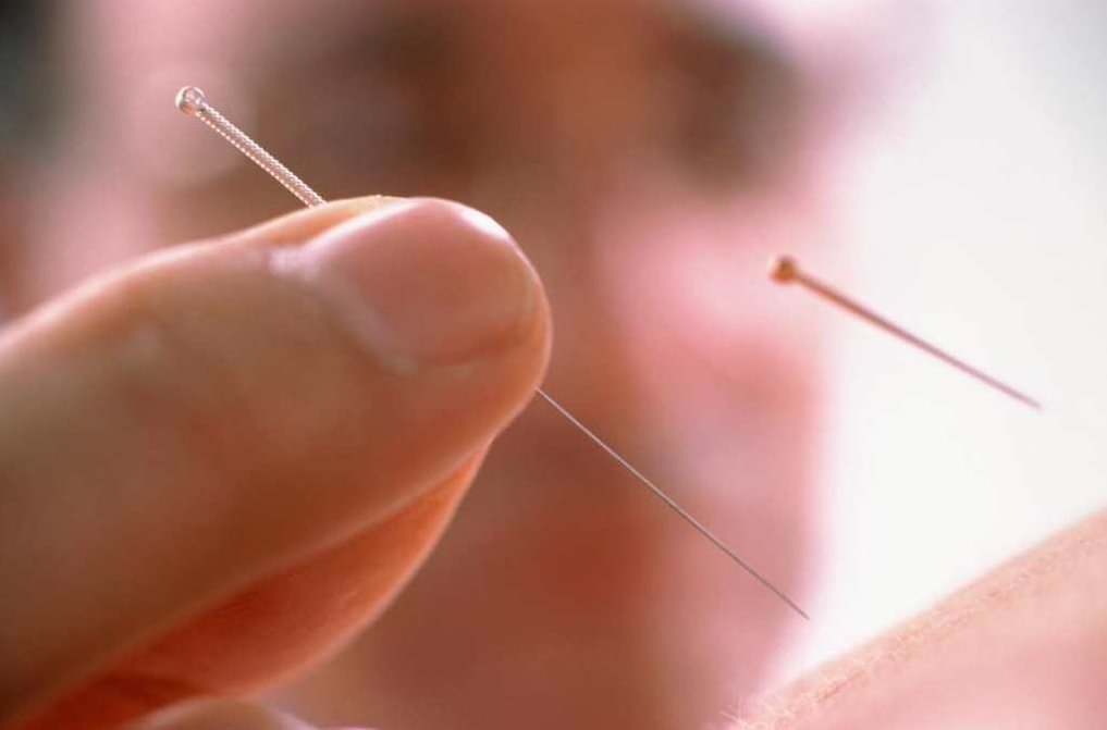 《针炙方法及常用穴位取穴法》增加《经外奇穴的部位和临床应用》,应用,第1张