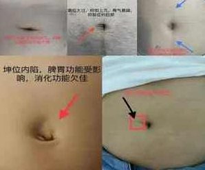 齐永老师初级脐针中医讲解,基础,第1张